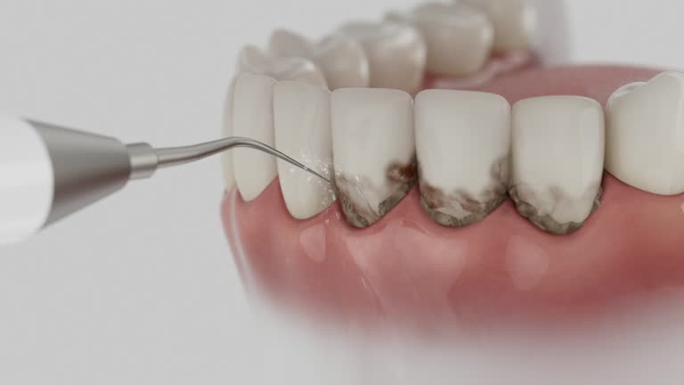 Reliable Emergency Dentist contractor in St. Clair, MO by Smile Center Dentistry